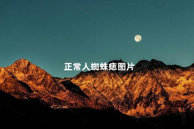 正常人蜘蛛痣图片