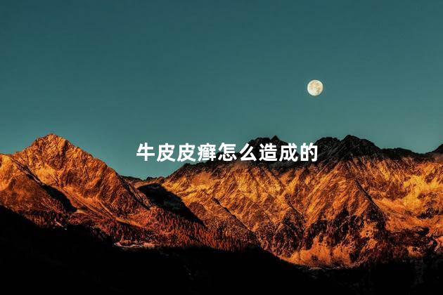 牛皮皮癣怎么造成的